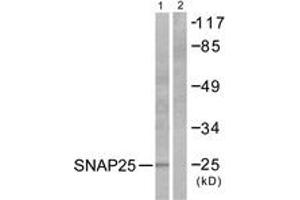 Western blot analysis of extracts from Raw264. (SNAP25 antibody  (AA 151-200))