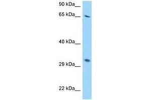 Image no. 1 for anti-Ribosomal Protein S2 (RPS2) (AA 46-95) antibody (ABIN6748129) (RPS2 antibody  (AA 46-95))