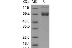 Western Blotting (WB) image for Interferon gamma Receptor 1 (IFNGR1) (Active) protein (Fc Tag) (ABIN7196272) (IFNGR1 Protein (Fc Tag))