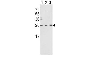 Western blot analysis of TPI1 Antibody (N-term) (ABIN389457 and ABIN2839524) in Y79(lane 1),CEM(lane 2) cell line and mouse brain tissue(lane 3) lysates (35 μg/lane). (TPI1 antibody  (N-Term))
