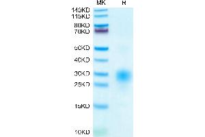 BST2 Protein (AA 49-161) (His tag)