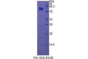 SDS-PAGE analysis of Rat Glucosidase beta , Acid Protein. (GBA Protein)