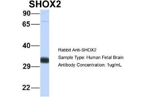 Host: Rabbit Target Name: SHOX2 Sample Type: Human Fetal Brain Antibody Dilution: 1. (SHOX2 antibody  (N-Term))