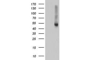 HEK293T cells were transfected with the pCMV6-ENTRY control (Left lane) or pCMV6-ENTRY RNH1 (Right lane) cDNA for 48 hrs and lysed. (RNH1 antibody)