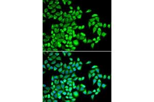 Immunofluorescence analysis of U2OS cells using  antibody (ABIN6131447, ABIN6136794, ABIN6136796 and ABIN6218313). (ALKBH1 antibody  (AA 110-389))