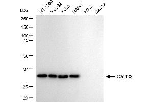 Western blotting analysis using C3orf38 antibody (ABIN7798078). (Recombinant C3orf38 antibody)