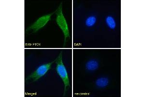 ABIN185667 Immunofluorescence analysis of paraformaldehyde fixed NIH3T3 cells, permeabilized with 0. (Patched 1 antibody  (Internal Region))