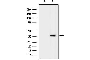 anti-Thromboxane A2 Receptor (TBXA2R) (C-Term) antibody