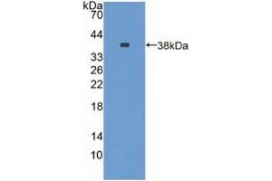 Detection of Recombinant NES, Rat using Polyclonal Antibody to Nestin (NES) (Nestin antibody  (AA 197-462))