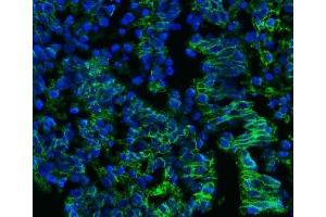 IF analysis of CD147/Emmprin using anti-CD147/Emmprin antibody (ABIN7599999). (CD147 antibody  (AA 138-323))