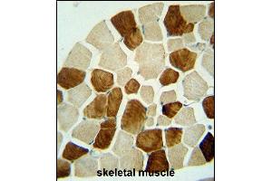 ZSWIM6 antibody (C-term) (ABIN654590 and ABIN2844290) immunohistochemistry analysis in formalin fixed and paraffin embedded human skeletal muscle followed by peroxidase conjugation of the secondary antibody and DAB staining. (ZSWIM6 antibody  (C-Term))