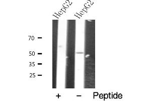 Western blot analysis of extracts from HepG2 cells, using VIPR2 antibody. (VIPR2 antibody  (Internal Region))