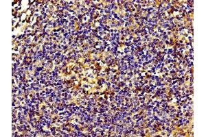 Immunohistochemistry (IHC) image for anti-Actinin, alpha 4 (ACTN4) (AA 160-440) antibody (ABIN7143827)