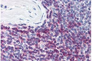 Human Spleen (formalin-fixed, paraffin-embedded) stained with CD7 antibody ABIN298827 at 5 ug/ml followed by biotinylated anti-mouse IgG secondary antibody ABIN481714, alkaline phosphatase-streptavidin and chromogen. (CD7 antibody)