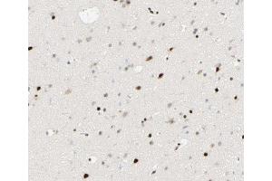 Immunohistochemistry (IHC) image for anti-Peroxisome Proliferator-Activated Receptor gamma (PPARG) (pSer112) antibody (ABIN6256109)
