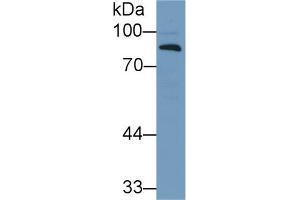 Western Blot; Sample: Human Lung lysate; Primary Ab: 1µg/ml Rabbit Anti-Human CFB Antibody Second Ab: 0. (Complement Factor B antibody  (AA 270-388))