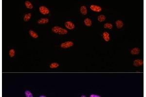 Immunofluorescence analysis of U2OS cells using Phospho-Smad2(S465/467)/Smad3(S423/425) Polyclonal Antibody at dilution of 1:100. (SMAD2 antibody  (pSer423, pSer425, pSer465, pSer467))