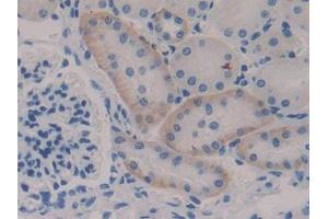 DAB staining on IHC-P; Samples: Mouse Kidney Tissue (NFKBIE antibody  (AA 115-350))