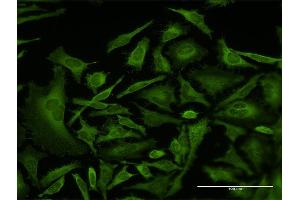 Immunofluorescence of monoclonal antibody to CAP1 on HeLa cell. (CAP1 antibody  (AA 1-475))