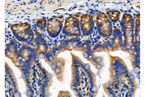 ABIN6257634 and ABIN6274771 at 1/100 staining Mouse colorectal tissue by IHC-P. (RPL18 antibody  (C-Term))