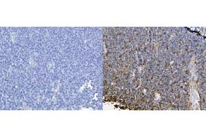 IHC analysis of CXCL12 using anti-CXCL12 antibody (ABIN6719467). (CXCL12 antibody  (AA 24-93))