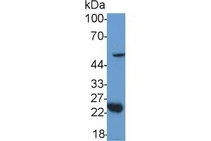 Detection of GDF11 in Mouse Cerebellum lysate using Polyclonal Antibody to Growth Differentiation Factor 11 (GDF11) (GDF11 antibody  (AA 299-407))