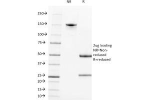 SDS-PAGE Analysis Purified CD21 / CR2 Mouse Monoclonal Antibody (CR2/1952). (CD21 antibody  (AA 44-196))