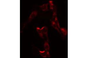 ABIN6274358 staining HepG2 by IF/ICC. (FASTKD3 antibody  (N-Term))