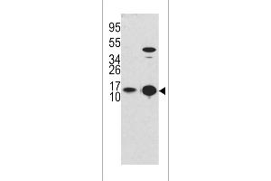 Western blot analysis of G8b (M1LC3B) Antibody (T6) 1802d in Y79 cell line lysates and mouse brain tissue lysates (35 μg/lane). (MAP1LC3A antibody  (AA 1-30))