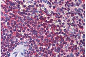 Human Spleen: Formalin-Fixed, Paraffin-Embedded (FFPE) (STIP1 antibody  (AA 1-544))