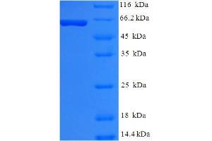 SDS-PAGE (SDS) image for Premelanosome Protein (PMEL) (AA 25-467) protein (His-SUMO Tag) (ABIN5710360) (Melanoma gp100 Protein (AA 25-467) (His-SUMO Tag))