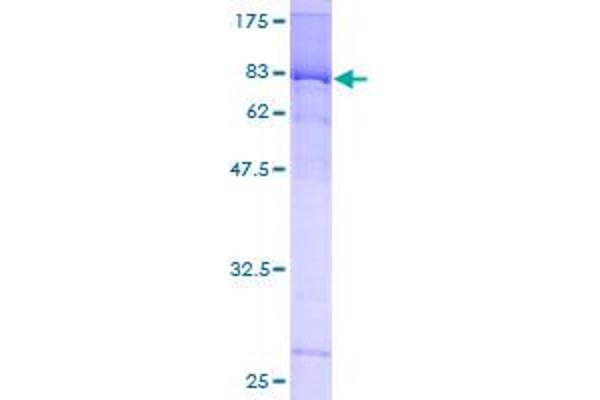 MEF2D Protein (AA 1-514) (GST tag)