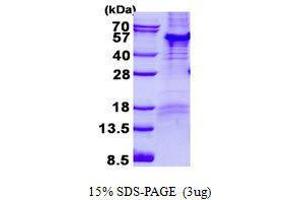 Figure annotation denotes ug of protein loaded and % gel used. (PARD6B Protein)