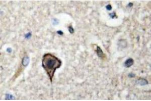 Immunohistochemistry (IHC) analyzes of TWEAK antibody in paraffin-embedded human brain tissue. (TWEAK antibody)