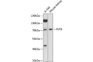 Western blot analysis of extracts of various cell lines, using FUT8 antibody (ABIN6132001, ABIN6140827, ABIN6140828 and ABIN6216749) at 1:3000 dilution. (FUT8 antibody  (AA 376-575))