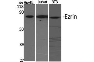 Western Blotting (WB) image for anti-Ezrin (EZR) antibody (ABIN5958385) (Ezrin antibody)