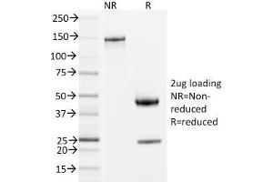 SDS-PAGE Analysis Purified ZAP70 Mouse Monoclonal Antibody (ZAP70/20535). (ZAP70 antibody  (AA 247-382))