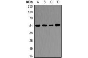 Western blot analysis of Ornithine Decarboxylase expression in Hela (A), THP1 (B), mouse kidney (C), mouse skeletal muscle (D) whole cell lysates.
