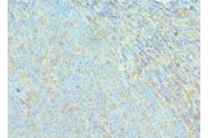Immunohistochemistry of paraffin-embedded human tonsil tissue using ABIN7143076 at dilution of 1:100 (ACTR2 antibody  (AA 1-160))