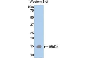 Detection of Recombinant SPTAN1, Human using Polyclonal Antibody to Alpha-Fodrin (SPTAN1) (SPTAN1 antibody  (AA 289-408))