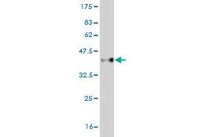 Western Blot detection against Immunogen (36. (CBX2 antibody  (AA 66-165))