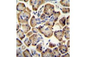 Formalin fixed and paraffin embedded Human pancreas tissue stained with RADIL Antibody (C-term) followed by peroxidase conjugation of the secondary antibody and DAB staining. (Radil antibody  (C-Term))