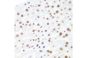 Immunohistochemistry of paraffin-embedded mouse liver using AGO2 antibody (ABIN5973585) at dilution of 1/100 (40x lens). (AGO2 antibody)
