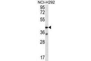 Western Blotting (WB) image for anti-Coagulation Factor II (thrombin) Receptor-Like 2 (F2RL2) antibody (ABIN2996634) (F2RL2 antibody)