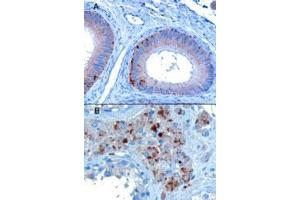 VPS35 polyclonal antibody  staining of paraffin embedded human testis showing A) Epithelial cells of the epididymis and B) Some leydig cells. (VPS35 antibody  (C-Term))