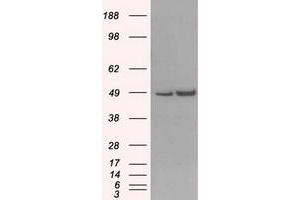 Western Blotting (WB) image for anti-LEM Domain Containing 3 (LEMD3) antibody (ABIN1499118)