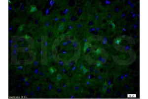 Formalin-fixed and paraffin embedded rat brain tissue labeled with Anti-NOS-2/iNOS Polyclonal Antibody, Unconjugated (ABIN677228) at 1:200 followed by conjugation to the secondary antibody Goat Anti-Rabbit IgG, FITC conjugated used at 1:200 dilution for 40 minutes at 37°C and DAPI