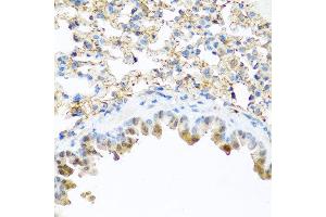 Immunohistochemistry of paraffin-embedded mouse lung using PI3 antibody at dilution of 1:100 (40x lens).