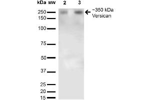 Western Blot analysis of Rat Brain Membrane and brain showing detection of 350kDa Versican protein using Mouse Anti-Versican Monoclonal Antibody, Clone S351-23 . (Versican antibody  (AA 362-585) (Atto 594))