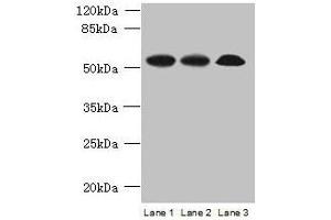 Western blot All lanes: SPERT antibody at 7 μg/mL Lane 1: Rat gonadal tissue Lane 2: Mouse lung tissue Lane 3: A549 whole cell lysate Secondary Goat polyclonal to rabbit IgG at 1/10000 dilution Predicted band size: 52, 48 kDa Observed band size: 52 kDa (SPERT antibody  (AA 1-412))